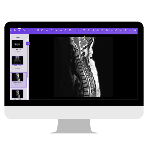 Feature image
